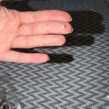 Yemeksepeti Yabancı Madde İçeren Waffle’da Hijyen İhlali Ve Ücret İadesi Talebi