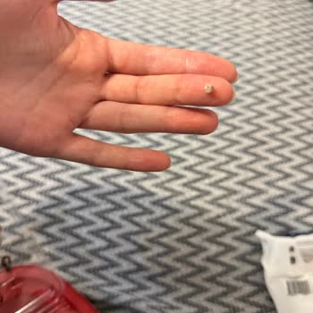 Yemeksepeti Yabancı Madde İçeren Waffle’da Hijyen İhlali Ve Ücret İadesi Talebi
