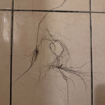 PH Lab Saç Maskesi Kullanım Sonrası Şiddetli Saç Dökülmesi Ve Cilt Yanması