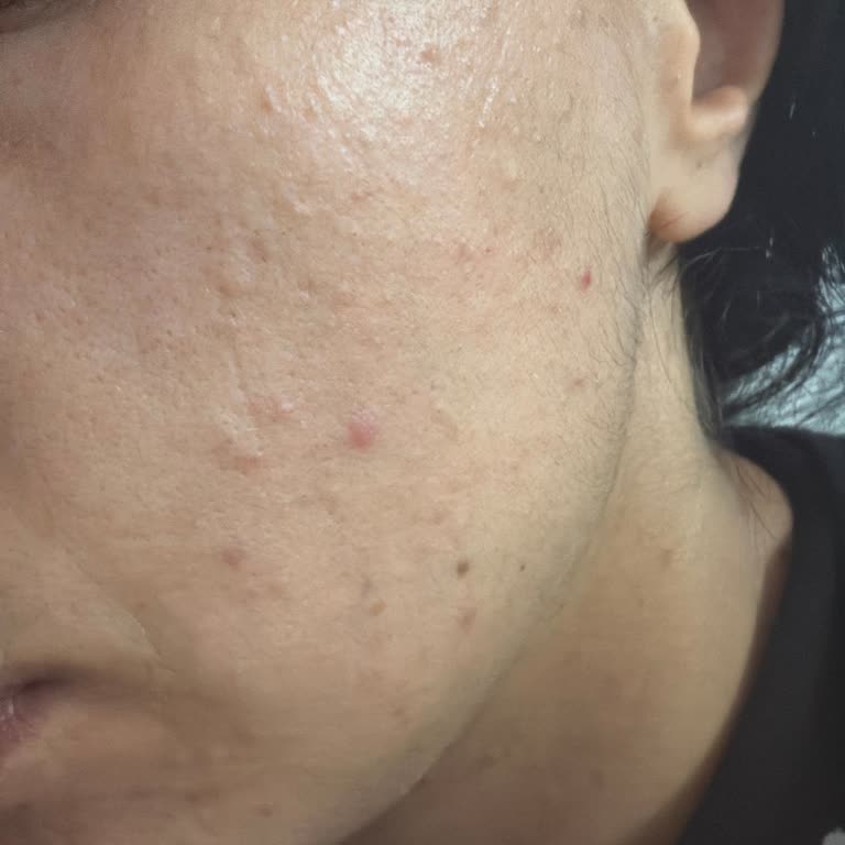 Missha Glow Tone Up Sun Base SPF50 Güneş Kremi Cildimde Akne Oluşturdu, İade Talebi