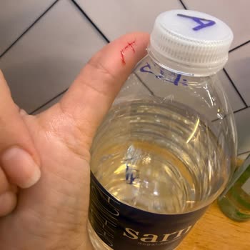 Kapağındaki Sivri Çıkıntı Çocukları Ve Kullanıcıları Tehlikeye Atıyor