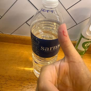 Kapağındaki Sivri Çıkıntı Çocukları Ve Kullanıcıları Tehlikeye Atıyor