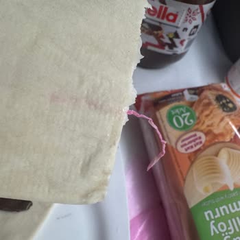 Superfresh Tereyağlı Milföy Hamurunda Poşet Parçası Bulunduğu İçin Güven Sarsıldı