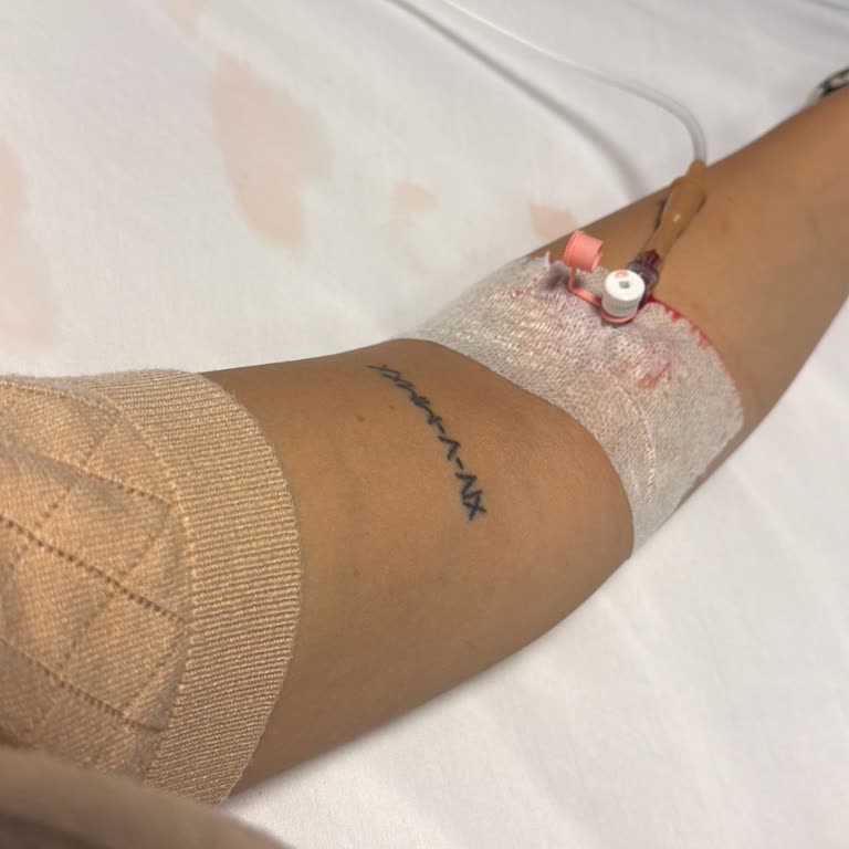 Sanko Üniversitesi Hastanesi Acil Servisinde Tecrübesiz Hemşirelerin Hatalı Damar Yolu Açması Nedeniyle Yaşanan Mağduriyet