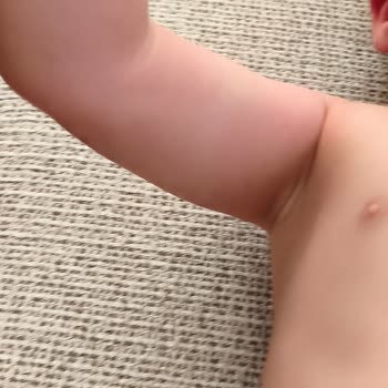 Bebekte Alerjik Kızarıklıklara Sebep Olan Ocean VM Argın Ürünü