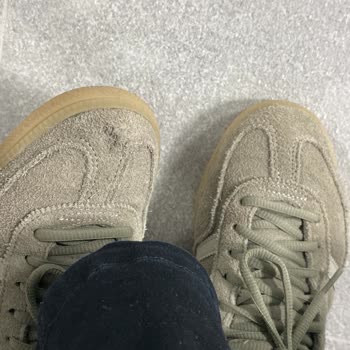Adidas Ayakkabısının Kısa Sürede Delinmesi Ve İade Talebi