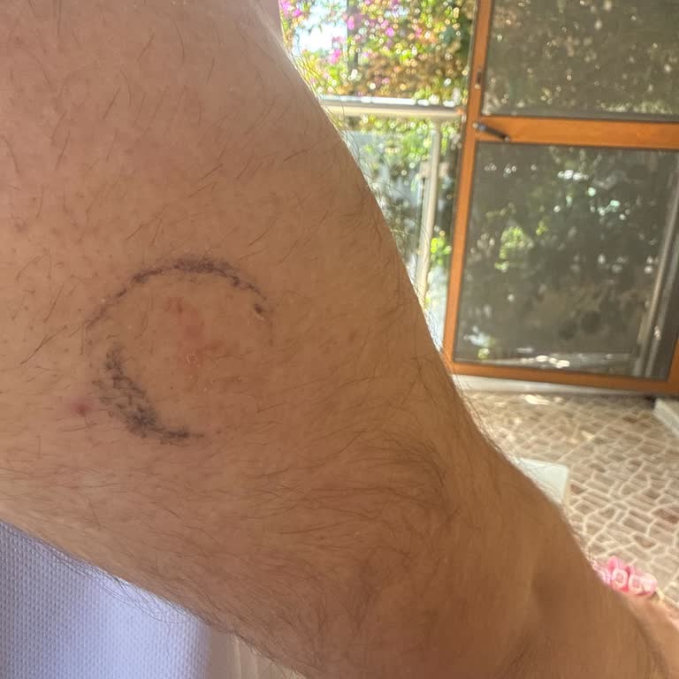 Sensör Kısa Sürede Çıktı, Ücretsiz Değişim Talebi