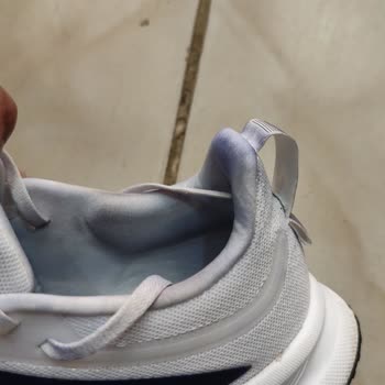 Renk Veren Adidas Ayakkabı Sağlık Riski Ve Uzun İnceleme Süreci