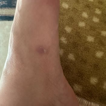 Ayak Vuran Ve Çatlak Tabanlı Derimod Terlik İçin İade Talebi Reddedildi