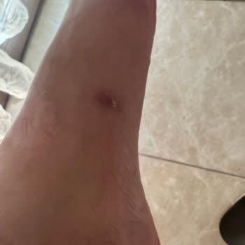 Defolu Derimod Terliği Ayağımı Vurdu, Tabanı Çatlak, İade Talebim Reddedildi