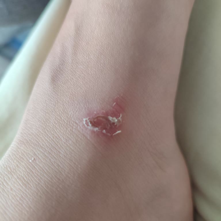Derimod Kadın Taba Tokalı Terlikte Ciddi Cilt Yaralanması Ve Kayganlık Nedeniyle İade Talebi