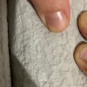 İstikbal Koltukta Teslim Sonrası Yırtık, Ücretsiz Garanti Tamiri Talep Ediyorum
