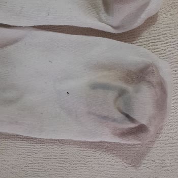 Ayakkabı Boyama Sorunu Ve Mağazanın Kullanıcı Hatası İddiası