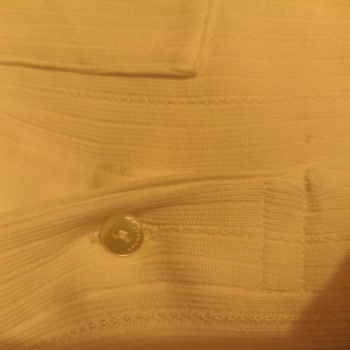 Lacoste Tişörtte Ürün Kalite Sorunu Ve Tutarsız İnceleme Süreci