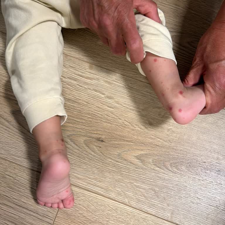 Hijyen Eksikliği Odada Ve Havuzda Bebeğimin Hastalanmasına Sebep Oldu