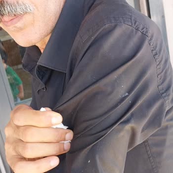 Ressa Cafe Bahçesindeki Kuş Dışkısı Hastane Hijyenini Tehlikeye Atıyor