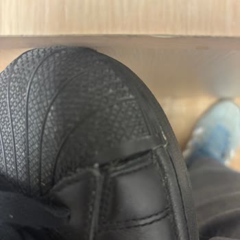Sürekli Açılan Adidas Superstar Ayakkabıda Değişim Ve İade Talebi