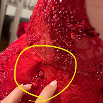 Hasarlı Elbise, Cüzdan Üzerinden İade Teklifi Ve Banka İadesi Talebi