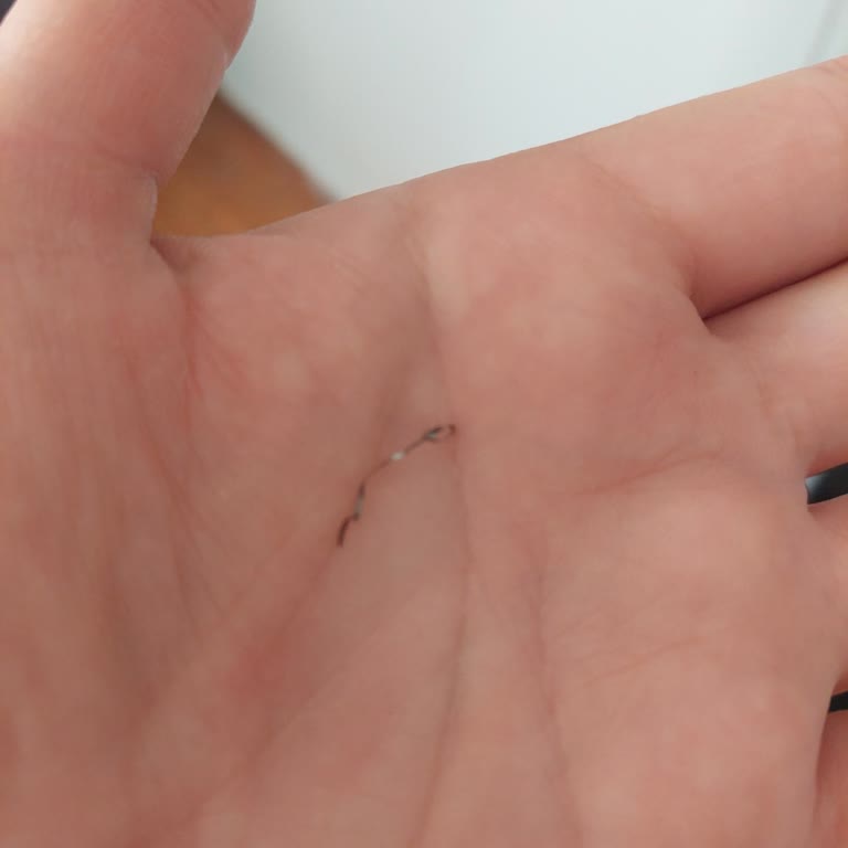 Dönerde Metal Tel Bulunması Çocuklar İçin Hayati Tehlike