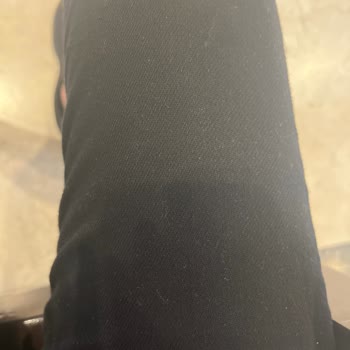 Mavi Pantolonun Kumaşı Anormal Derecede Tüy Ve Toz Topluyor