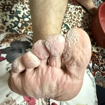 Niğde Özel Hayat Hastanesi Cildiye Polikliniğinde Haksız Yüksek Ücret Ve Yetersiz Tanı Şikayeti