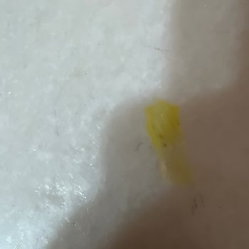BİM Lezzethane Dondurulmuş Mantıda Plastik Parça Tespiti