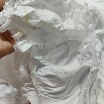 Molfix Bebek Bezinde Aşırı Sızdırma Ve Dolgu Eksikliği Nedeniyle Mağduriyet