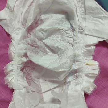 Molfix Bebek Bezinde Aşırı Sızdırma Ve Dolgu Eksikliği Nedeniyle Mağduriyet