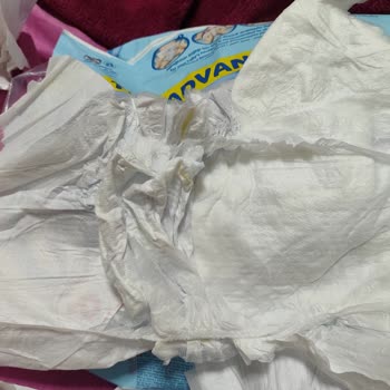 Molfix Bebek Bezinde Aşırı Sızdırma Ve Dolgu Eksikliği Nedeniyle Mağduriyet