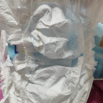 Molfix Bebek Bezinde Aşırı Sızdırma Ve Dolgu Eksikliği Nedeniyle Mağduriyet