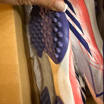 Intersport Adidas Çocuk Ayakkabısı Ayaklarını Yaraladı, İade Talebi