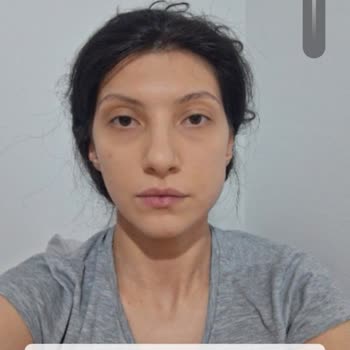 Kiko Milano Sanal Makyaj Uygulaması Renk Uyumsuzluğu Ve İade Reddi