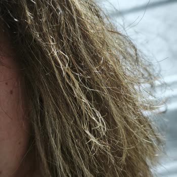Icon Hair   8.000 TL'lik Perma Sonrası Saç Hasarı Ve İade Talebi