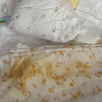 Sleepy Natural Bebek Bezlerinde Sızdırma Sorunu Ve Müşteri Hizmetlerinde Yetersiz Yardım