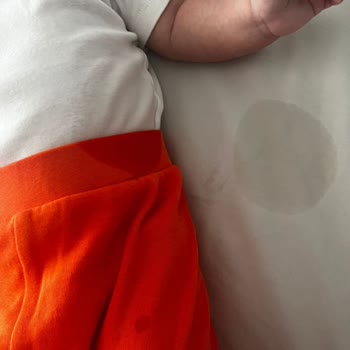 Sleepy Natural Bebek Bezlerinde Sızdırma Sorunu Ve Müşteri Hizmetlerinde Yetersiz Yardım