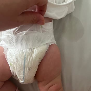Sleepy Natural Bebek Bezlerinde Sızdırma Sorunu Ve Müşteri Hizmetlerinde Yetersiz Yardım