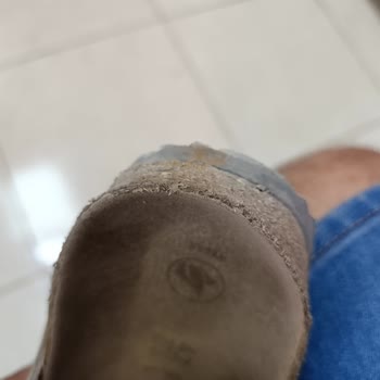 Birkenstock Arizona Terliği Kısa Sürede Mantar Tabanı Dağılması Ve Yan Kısımların Açılması