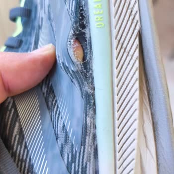 Adidas Ayakkabısındaki Üretim Hatası Kullanıcı Hatası Olarak Reddedildi