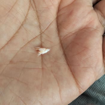 Pınar Aç Bitir Hindi Salamında Tüy Benzeri Yabancı Madde Görülmesi