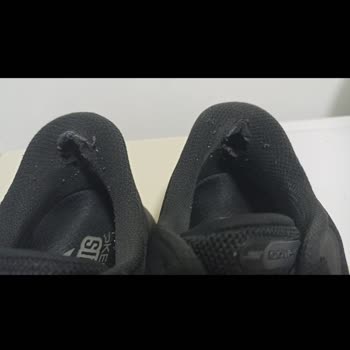 Skechers Ayakkabıda Yırtılma, Fiziksel İnceleme Ve Garanti Talebi