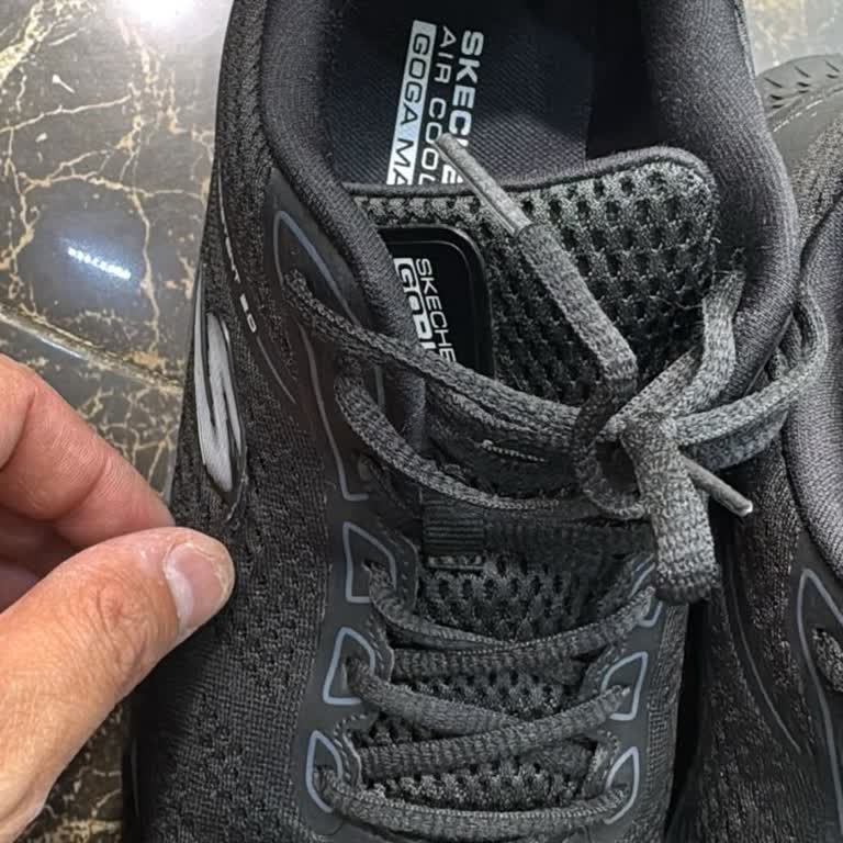 Skechers Ayakkabısının Logo Parçası Kaldı Ve Kullanıcı Hatası İddiası
