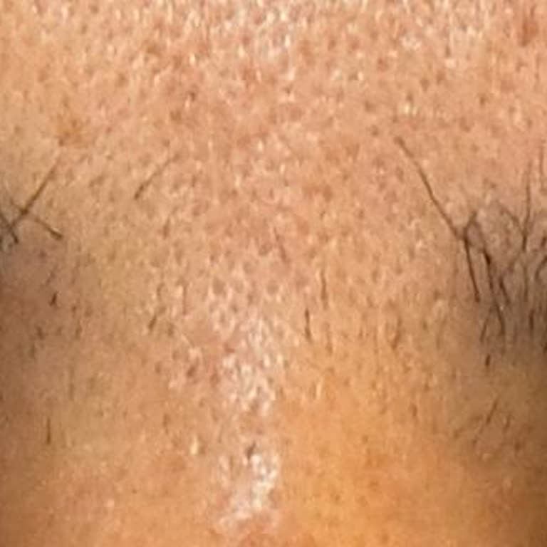 Hijyen Eksikliği Ve Aşırı Ücretlendirme Nedeniyle Kaş Laminasyon Hizmetinin İadesi Talebi