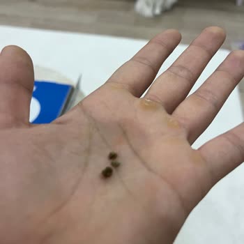 Domino’s Pizza’da İçinden Taş Çıktı Ve Sipariş Eksik Teslim Edildi