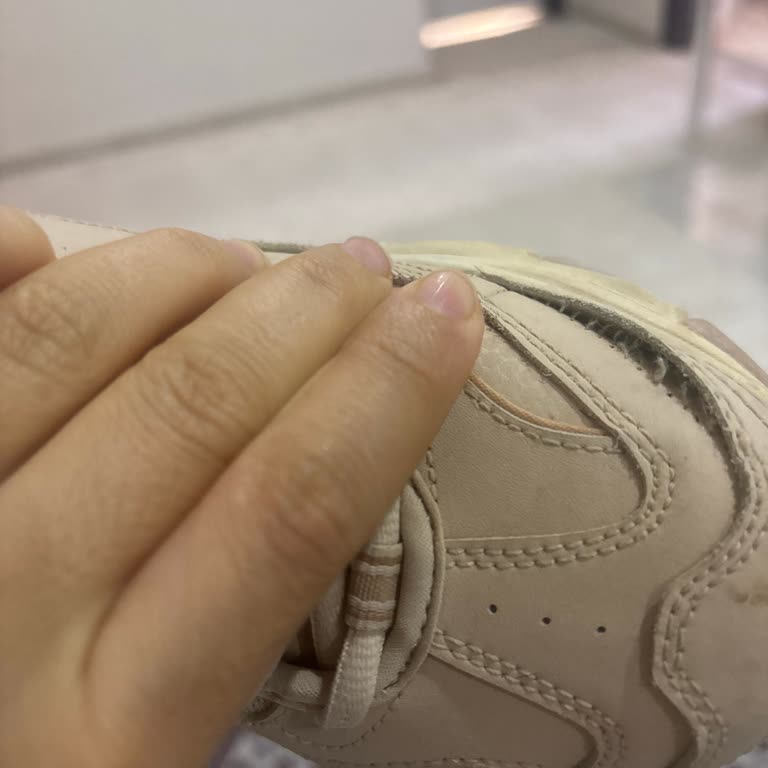 Kısa Sürede Dikiş Açılan Skechers Ayakkabısında Red Kararı