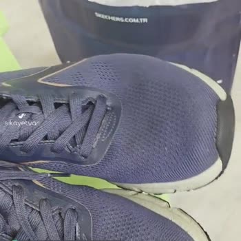 Skechers Ayakkabıların Tabanları Parçalandı, Kullanıcı Hatası Denildi