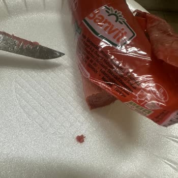 Banvit Baton Sucukta Kıl Bulunması Ve Müşteri Hizmetlerine Ulaşılamaması