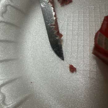 Banvit Baton Sucukta Kıl Bulunması Ve Müşteri Hizmetlerine Ulaşılamaması