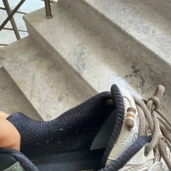 Skechers D'Lites Ayakkabısının İç Astarındaki Açılma Ve Tüylenme Sorunu