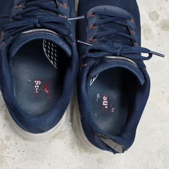 Skechers Slip‑Ins Özelliği Üç Ayda Deforme Olmuş Ve Topuk Yırtılmış