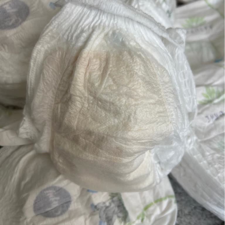 Sleepy 3 Numaralı Külot Bezinde Sapsarı Görünüm Güvenimi Sarstı